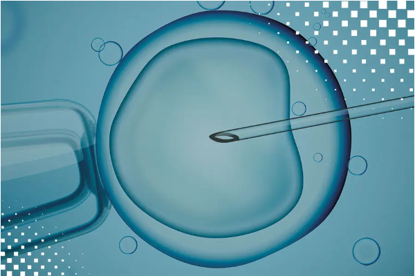IVF